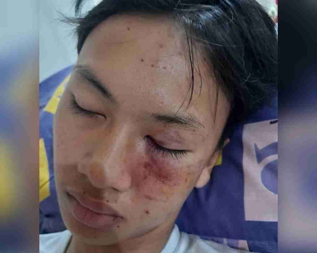 M.Basir Orang Tua Siswa Korban Penganiyayaan Minta Pelaku Segera Ditangkap M.Basir Orang Tua Siswa Korban Penganiyayaan Minta Pelaku Segera Ditangkap