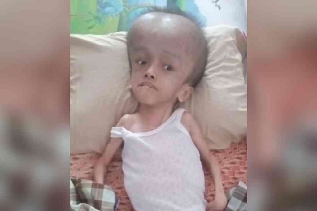 Alhamdulillah, Bantuan Untuk Muhammad Cardo Terus Mengalir Alhamdulillah, Bantuan Untuk Muhammad Cardo Terus Mengalir