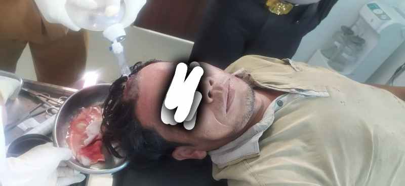 Seorang Pria Ditembak di Warung Kopi, Jatanras Selidiki Pelaku Seorang Pria Ditembak di Warung Kopi, Jatanras Selidiki Pelaku