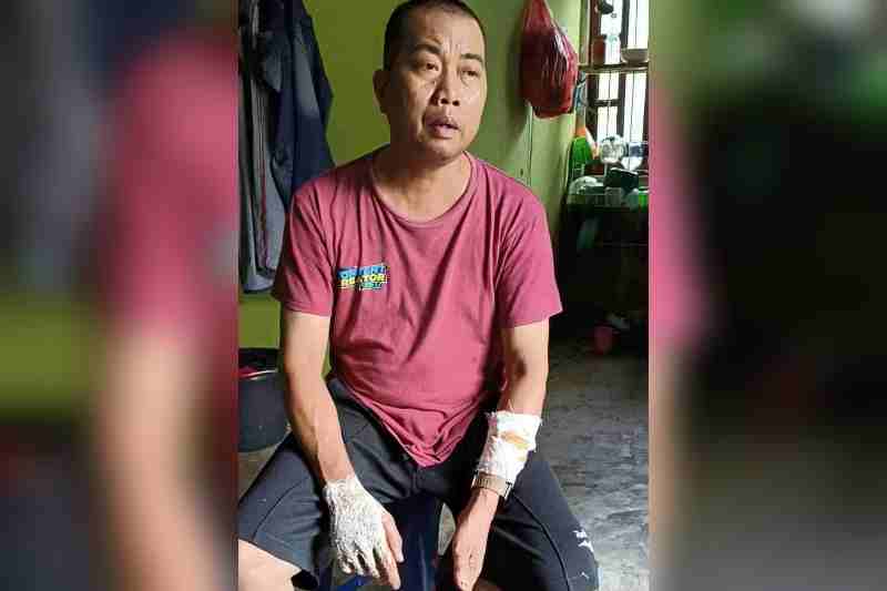Nyaris Dibegal Tangan Kena Celurit, Owner Pangkas Borneo Lawan Dua Pelaku di Jalan Sepi Sergai Nyaris Dibegal Tangan Kena Celurit, Owner Pangkas Borneo Lawan Dua Pelaku di Jalan Sepi Sergai